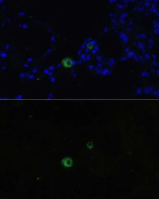 IHC-P analysis of rat lung tissue using GTX02874 C6ORF150 antibody. Blue : DAPI Dilution : 1:100