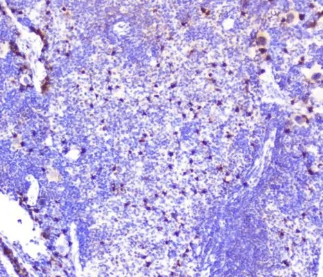 IHC-P analysis of mouse spleen tissue using GTX02876 SDF1 antibody. Antigen retrieval : Heat mediated antigen retrieval was performed in citrate buffer (pH6, epitope retrieval solution) for 20 mins Dilution : 1microg/ml