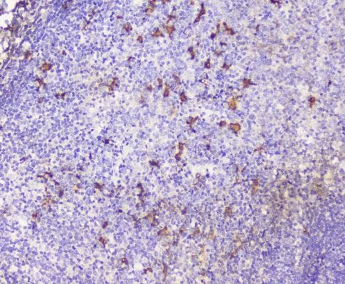 IHC-P analysis of human tonsil tissue using GTX02876 SDF1 antibody. Antigen retrieval : Heat mediated antigen retrieval was performed in citrate buffer (pH6, epitope retrieval solution) for 20 mins Dilution : 1microg/ml