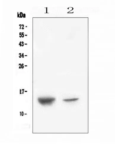 WB analysis of various samples using GTX02876 SDF1 antibody. Lane 1 : human placenta tissue lysate Lane 2 : A431 whole cell lysate Dilution : 0.5 microg/ml