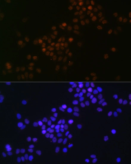 ICC/IF analysis of HeLa cells using GTX02877 c-Myc antibody [GT1265]. Red : Primary antibody Blue : DAPI Dilution : 1:100