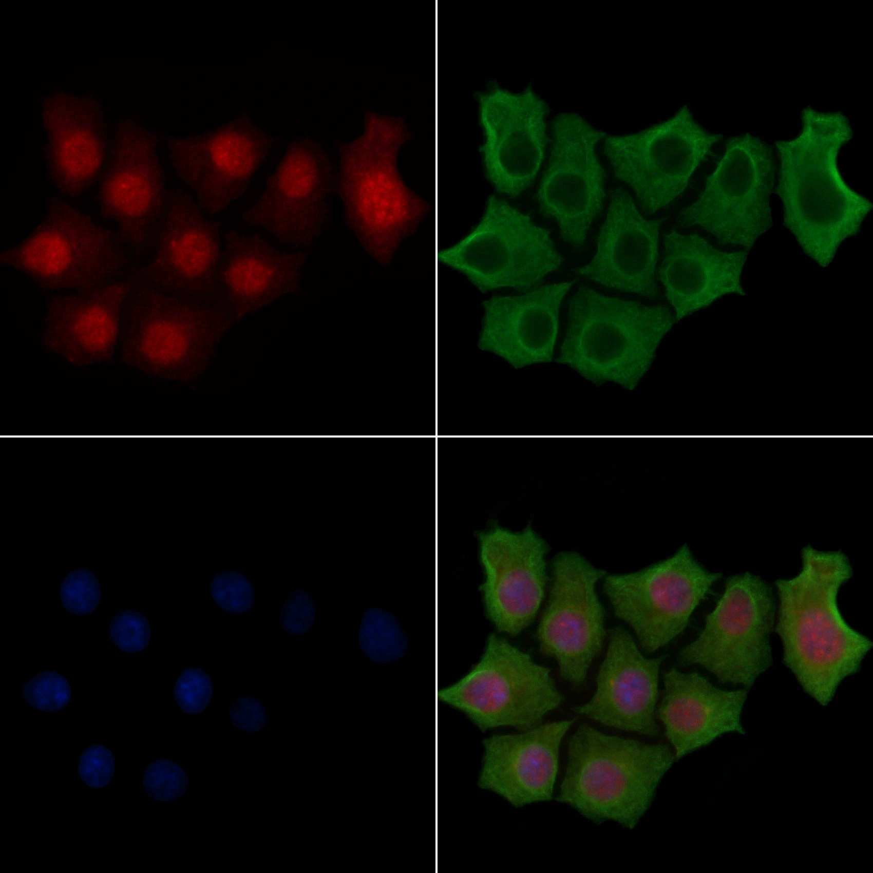 ICC/IF analysis of PFA-fixed HepG2 cells (30min of 4microM Forskolin treatment) using GTX02883 IRF3 (phospho Ser396) antibody. Red : Primary antibody Green : Beta tubulin Blue : DAPI Permeabilization : 0.1% Triton X-100