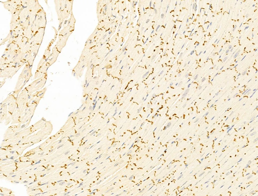 IHC-P analysis of mouse heart tissue using GTX02883 IRF3 (phospho Ser396) antibody. Antigen retrieval : Heat mediated antigen retrieval step in citrate buffer was performed Dilution : 1:100