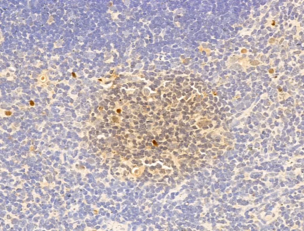 IHC-P analysis of mouse thymus tissue using GTX02883 IRF3 (phospho Ser396) antibody. Antigen retrieval : Heat mediated antigen retrieval step in citrate buffer was performed Dilution : 1:100