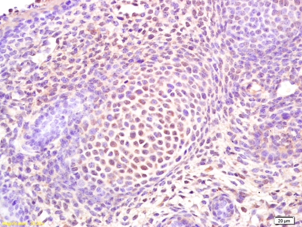 IHC-P analysis of mouse embryo tissue using GTX02884 SP7 antibody. Dilution : 1:200 IHC-P analysis of mouse embryo tissue using GTX02884 SP7 antibody. Dilution : 1:200