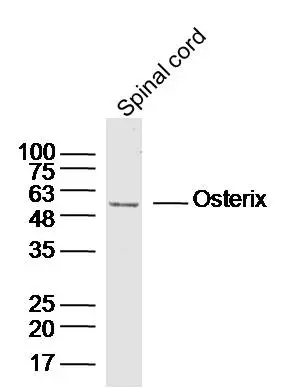 WB analysis of mouse spinal cord tissue lysate using GTX02884 SP7 antibody. Dilution : 1:300