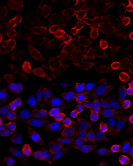 ICC/IF analysis of PFA-fixed HeLa cells using using GTX02885 HDAC6 antibody. Red : Primary antibody Blue : DAPI Dilution : 1:100