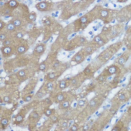 IHC-P analysis of human liver tissue section using GTX02885 HDAC6 antibody. Dilution : 1:400