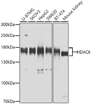 WB analysis of various samples using GTX02885 HDAC6 antibody. Dilution : 1:1000 Loading : 25microg