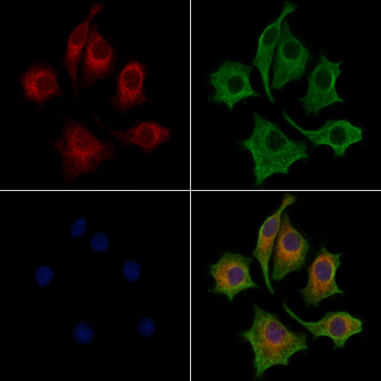 ICC/IF analysis of PFA-fixed HepG2 cells using GTX02887 LASS2 Antibody. Red : Primary antibody Green : Tubulin Blue : DAPI Permeabilization : 0.1% Triton X-100