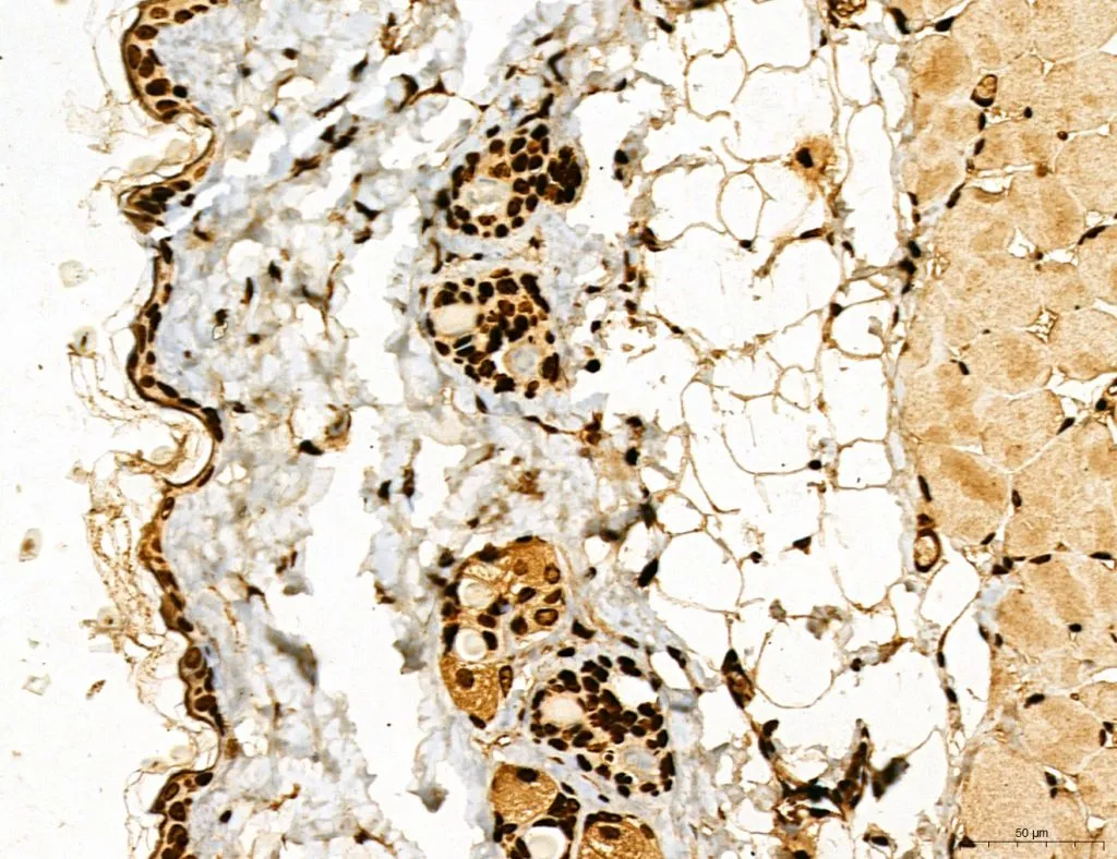 IHC-P analysis of mouse skin tissue using GTX02887 LASS2 Antibody. Antigen retrieval : Heat mediated antigen retrieval step in citrate buffer was performed Dilution : 1:100