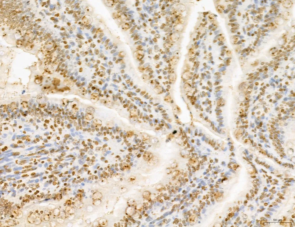 IHC-P analysis of rat colon tissue using GTX02887 LASS2 Antibody. Antigen retrieval : Heat mediated antigen retrieval step in citrate buffer was performed Dilution : 1:100