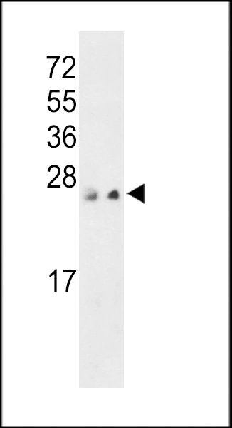WB analysis of MCF-7 and 293 whole cell lysates using GTX02889 PTP4A3 antibody. Loading : 35 microg per lane