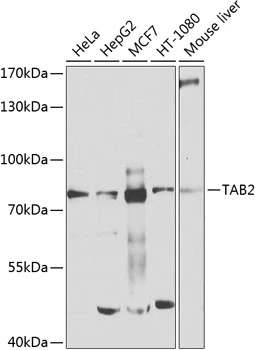 WB analysis of various samples using GTX02890 TAB2 antibody. Dilution : 1:1000 Loading : 25microg per lane