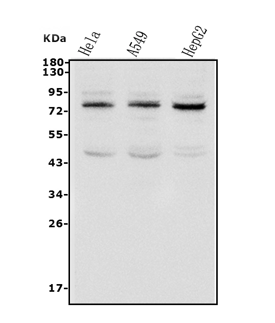 WB analysis of various samples using GTX02891 TAB2 antibody. Lane 1 : HeLa whole cell lysate Lane 2 : A549 whole cell lysate Lane 3 : HepG2 whole cell lysate Dilution : 0.5 microg/ml Loading : 50microg per lane
