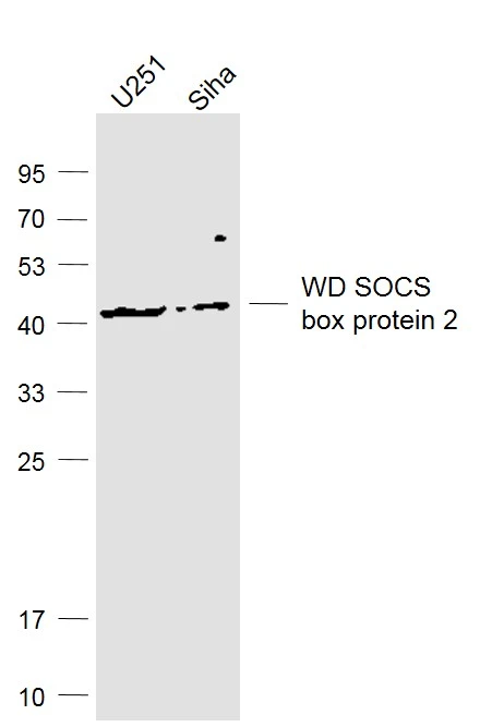 WB analysis of various sample lysates using GTX03039 WSB2 antibody. Lane 1 : U251 cell Lane 2 : Siha cell Dilution : 1:1000