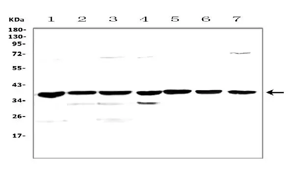WB analysis of various sample lysates using GTX03117 uPAR antibody. Lane 1 : rat pancreas tissue lysate Lane 2 : rat small intestine tissue lysate Lane 3 : rat kidney tissue lysate Lane 4 : mouse brain tissue lysate Lane 5 : mouse pancreas tissue lysate Lane 6 : mouse kidney tissue lysate Lane 7 : mouse testis tissue lysate Dilution : 0.5 microg/ml Loading : 50microg of each lane WB analysis of various sample lysates using GTX03117 uPAR antibody. Lane 1 : rat pancreas tissue lysate Lane 2 : rat small intestine tissue lysate Lane 3 : rat kidney tissue lysate Lane 4 : mouse brain tissue lysate Lane 5 : mouse pancreas tissue lysate Lane 6 : mouse kidney tissue lysate Lane 7 : mouse testis tissue lysate Dilution : 0.5 microg/ml Loading : 50microg of each lane