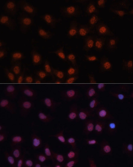 ICC/IF analysis of HeLa cells using GTX03119 CDKN2A / p16INK4a antibody. Blue : DAPI for nuclear staining Dilution : 1:100 ICC/IF analysis of HeLa cells using GTX03119 CDKN2A / p16INK4a antibody. Blue : DAPI for nuclear staining Dilution : 1:100