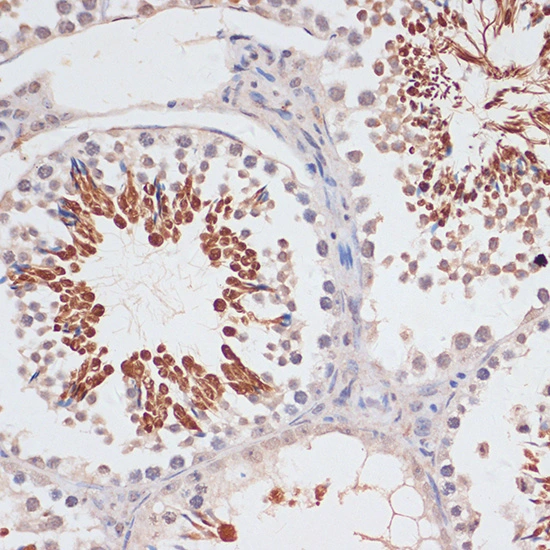 IHC-P analysis of mouse testis tissue using GTX03119 CDKN2A / p16INK4a antibody. Dilution : 1:100