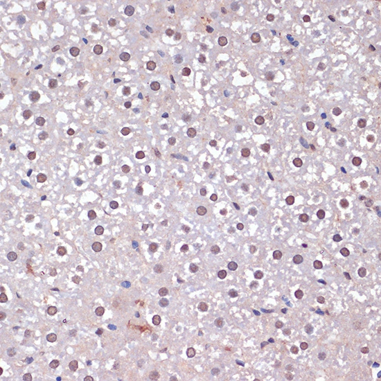 IHC-P analysis of rat liver tissue using GTX03119 CDKN2A / p16INK4a antibody. Dilution : 1:100