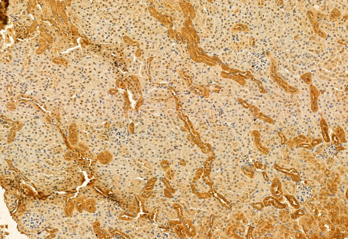 IHC-P analysis of mouse kidney tissue using GTX03170 SMCR7L antibody. Antigen retrieval : Heat mediated antigen retrieval step in citrate buffer was performed Dilution : 1:100 IHC-P analysis of mouse kidney tissue using GTX03170 SMCR7L antibody. Antigen retrieval : Heat mediated antigen retrieval step in citrate buffer was performed Dilution : 1:100