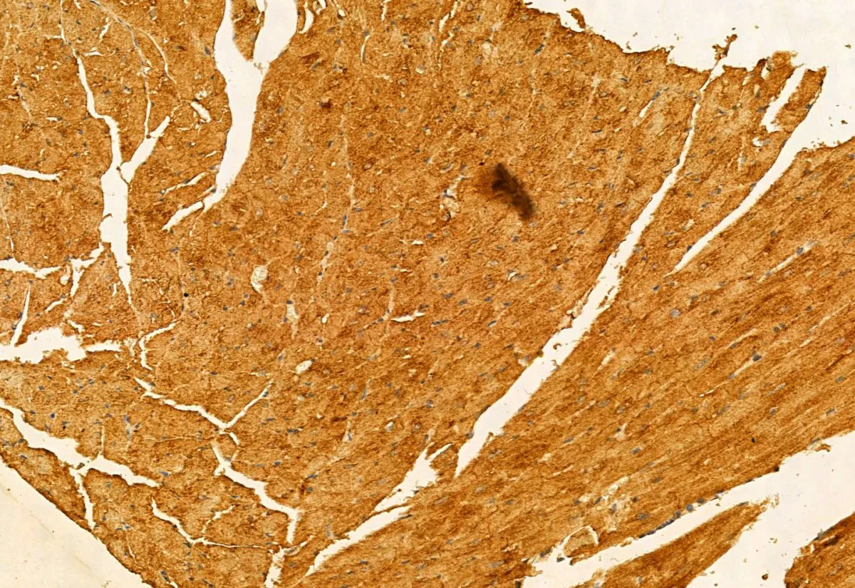 IHC-P analysis of mouse heart tissue using GTX03170 SMCR7L antibody. Antigen retrieval : Heat mediated antigen retrieval step in citrate buffer was performed Dilution : 1:100
