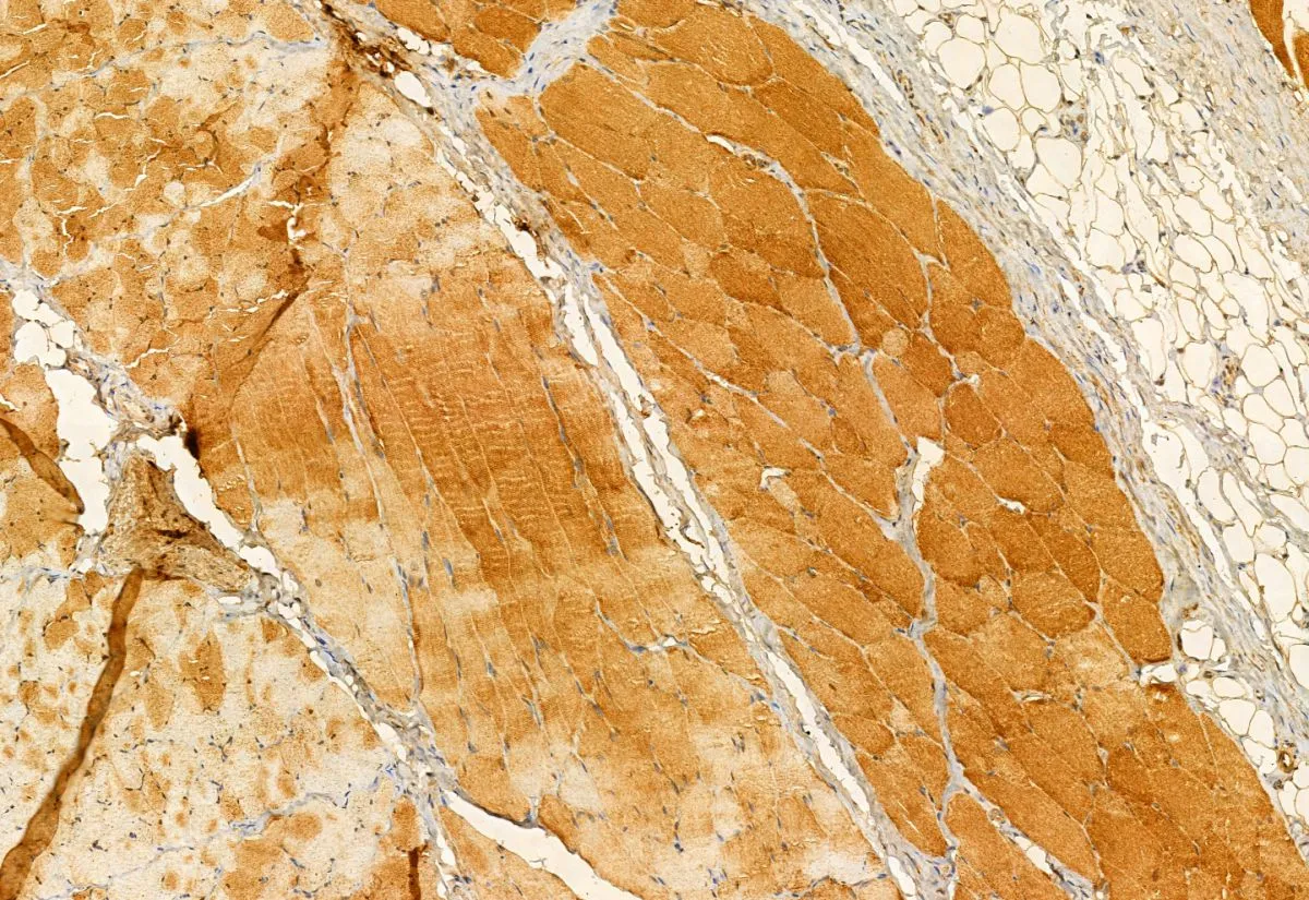 IHC-P analysis of rat skin tissue using GTX03170 SMCR7L antibody. Antigen retrieval : Heat mediated antigen retrieval step in citrate buffer was performed Dilution : 1:100