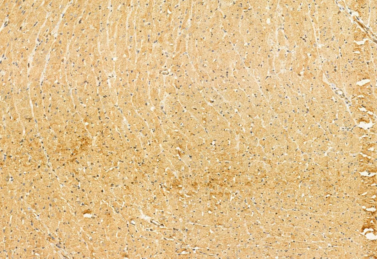IHC-P analysis of rat heart tissue using GTX03170 SMCR7L antibody. Antigen retrieval : Heat mediated antigen retrieval step in citrate buffer was performed Dilution : 1:100