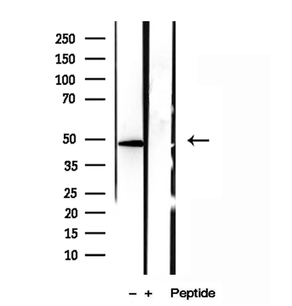 WB analysis of HT-1080 cell lysate using GTX03170 SMCR7L antibody.