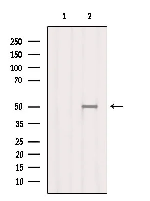 WB analysis of mouse liver tissue lysate using GTX03170 SMCR7L antibody. The lane on the left was treated with blocking peptide.