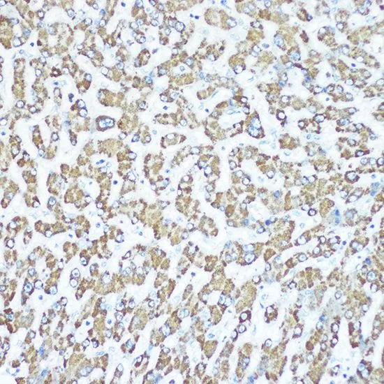 IHC-P analysis of human liver tissue section using GTX03186 CPS1 antibody [GT1274]. Dilution : 1:100