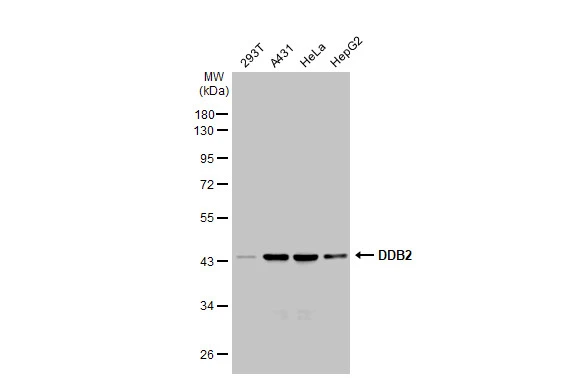 Various whole cell extracts (30 microg) were separated by 10% SDS-PAGE, and the membrane was blotted with DDB2 antibody [GT1277] (GTX03189) diluted at 1:1000. The HRP-conjugated anti-rabbit IgG antibody (GTX213110-01) was used to detect the primary antibody.