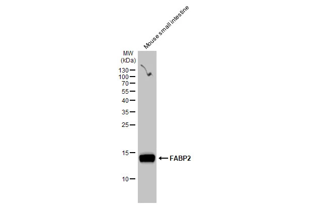 Mouse tissue extract (50 microg) was separated by 15% SDS-PAGE, and the membrane was blotted with FABP2 antibody [GT1280] (GTX03192) diluted at 1:500. The HRP-conjugated anti-rabbit IgG antibody (GTX213110-01) was used to detect the primary antibody.