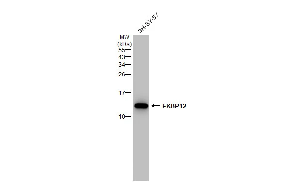 Whole cell extract (30 microg) was separated by 15% SDS-PAGE, and the membrane was blotted with FKBP12 antibody [GT1281] (GTX03193) diluted at 1:1000. The HRP-conjugated anti-rabbit IgG antibody (GTX213110-01) was used to detect the primary antibody.