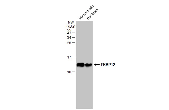 Various tissue extracts (50 microg) were separated by 15% SDS-PAGE, and the membrane was blotted with FKBP12 antibody [GT1281] (GTX03193) diluted at 1:1000. The HRP-conjugated anti-rabbit IgG antibody (GTX213110-01) was used to detect the primary antibody.