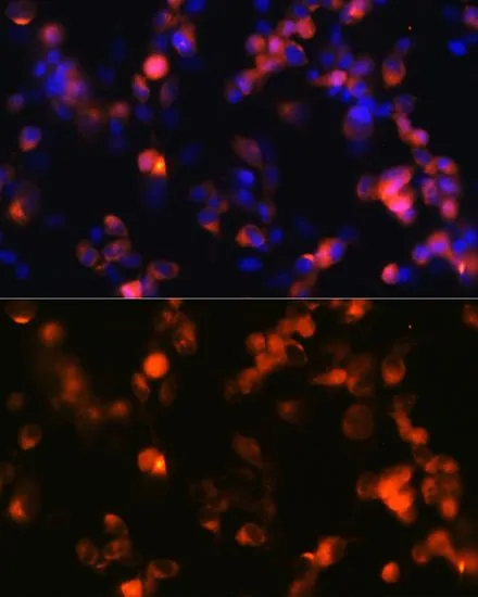 ICC/IF analysis of SH-SY5Y cells using GTX03195 GluR2 antibody [GT1283]. Blue : DAPI for nuclear staining Dilution : 1:100