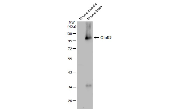 Various tissue extracts (50 microg) were separated by 10% SDS-PAGE, and the membrane was blotted with GluR2 antibody [GT1283] (GTX03195) diluted at 1:1000. The HRP-conjugated anti-rabbit IgG antibody (GTX213110-01) was used to detect the primary antibody.