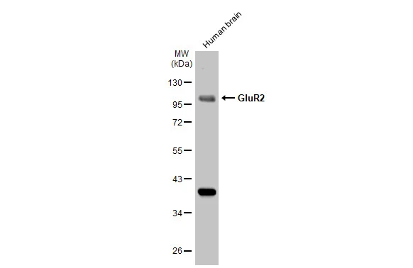 Human tissue extract (30 microg) was separated by 10% SDS-PAGE, and the membrane was blotted with GluR2 antibody [GT1283] (GTX03195) diluted at 1:1000. The HRP-conjugated anti-rabbit IgG antibody (GTX213110-01) was used to detect the primary antibody.