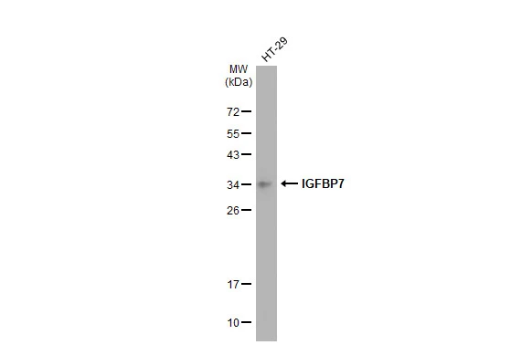 Whole cell extract (30 microg) was separated by 12% SDS-PAGE, and the membrane was blotted with IGFBP7 antibody [GT1286] (GTX03198) diluted at 1:1000. The HRP-conjugated anti-rabbit IgG antibody (GTX213110-01) was used to detect the primary antibody, and the signal was developed with Trident ECL plus-Enhanced.