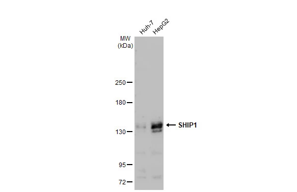 Various whole cell extracts (30 microg) were separated by 5% SDS-PAGE, and the membrane was blotted with SHIP1 antibody [GT1287] (GTX03199) diluted at 1:1000. The HRP-conjugated anti-rabbit IgG antibody (GTX213110-01) was used to detect the primary antibody.