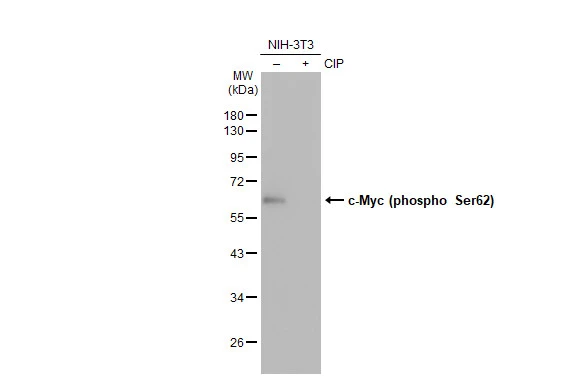 Untreated (-) and treated (+) NIH-3T3 whole cell extracts (30 microg) were separated by 10% SDS-PAGE, and the membrane was blotted with c-Myc (phospho Ser62) antibody [GT1295] (GTX03207) diluted at 1:500. The HRP-conjugated anti-rabbit IgG antibody (GTX213110-01) was used to detect the primary antibody.