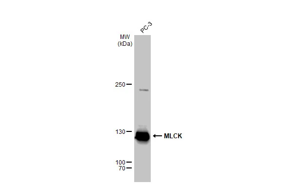Whole cell extract (30 microg) was separated by 5% SDS-PAGE, and the membrane was blotted with MLCK antibody [GT1296] (GTX03208) diluted at 1:1000. The HRP-conjugated anti-rabbit IgG antibody (GTX213110-01) was used to detect the primary antibody.