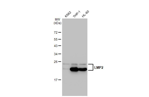 Various whole cell extracts (30 microg) were separated by 12% SDS-PAGE, and the membrane was blotted with LMP2 antibody [GT1307] (GTX03219) diluted at 1:1000. The HRP-conjugated anti-rabbit IgG antibody (GTX213110-01) was used to detect the primary antibody.