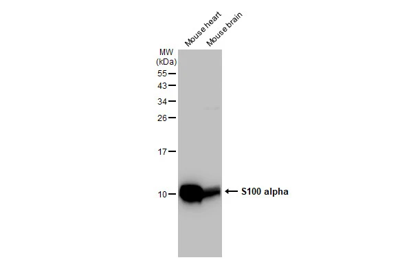 Various tissue extracts (50 microg) were separated by 15% SDS-PAGE, and the membrane was blotted with S100 alpha antibody [GT1311] (GTX03223) diluted at 1:5000. The HRP-conjugated anti-rabbit IgG antibody (GTX213110-01) was used to detect the primary antibody.
