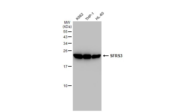 Various whole cell extracts (30 microg) were separated by 15% SDS-PAGE, and the membrane was blotted with SFRS3 antibody [GT1312] (GTX03224) diluted at 1:1000. The HRP-conjugated anti-rabbit IgG antibody (GTX213110-01) was used to detect the primary antibody.