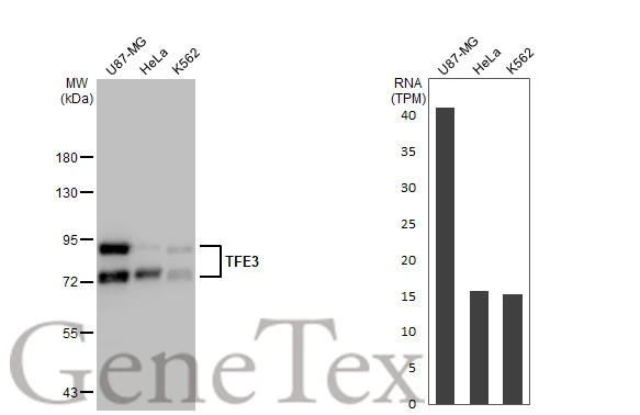 Various whole cell extracts (30 microg) were separated by 7.5% SDS-PAGE, and the membrane was blotted with TFE3 antibody [GT1317] (GTX03229) diluted at 1:1000. The HRP-conjugated anti-rabbit IgG antibody (GTX213110-01) was used to detect the primary antibody.