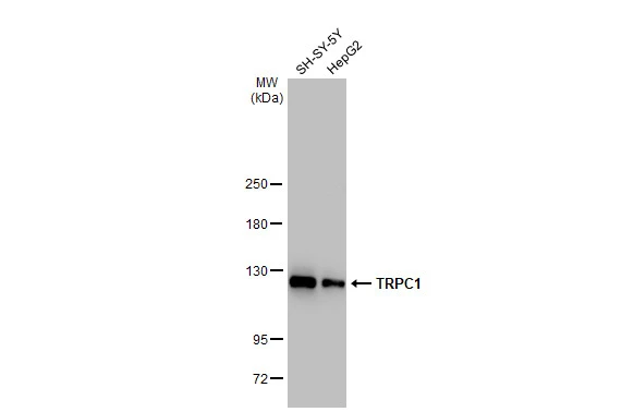 Various whole cell extracts (30 microg) were separated by 5% SDS-PAGE, and the membrane was blotted with TRPC1 antibody [GT1318] (GTX03230) diluted at 1:1000. The HRP-conjugated anti-rabbit IgG antibody (GTX213110-01) was used to detect the primary antibody.