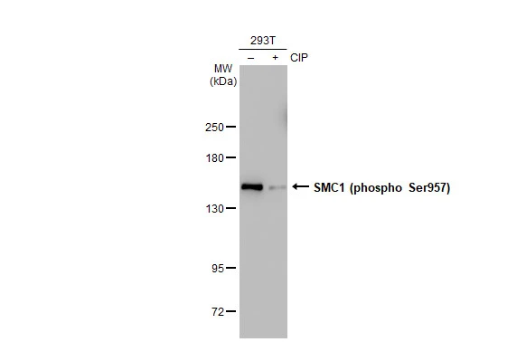 Untreated (-) and treated (+) 293T whole cell extracts (30 microg) were separated by 5% SDS-PAGE, and the membrane was blotted with SMC1 (phospho Ser957) antibody [GT1321] (GTX03233) diluted at 1:500. The HRP-conjugated anti-rabbit IgG antibody (GTX213110-01) was used to detect the primary antibody.