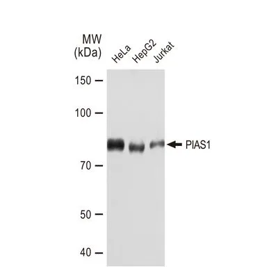 WB analysis of various samples using GTX03235 PIAS1 antibody [GT1323]. Dilution : 1:1000 Loading : 25microg per lane