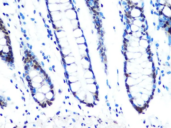 IHC-P analysis of human colon tissue section using GTX03236 DYNLL1 antibody [GT1324]. Dilution : 1:100